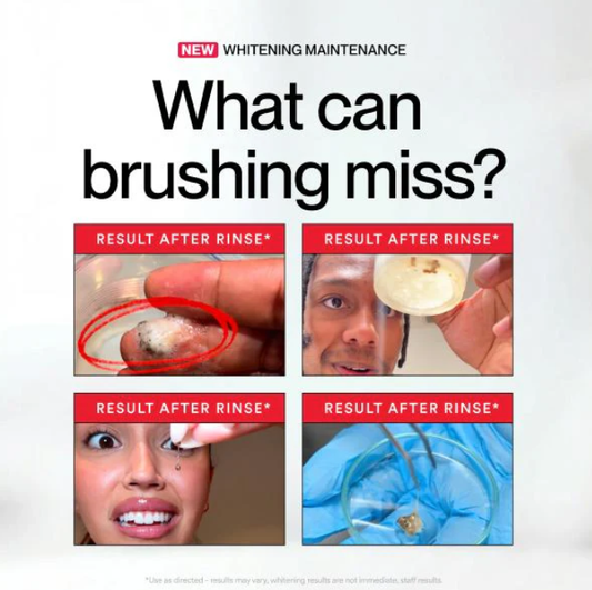 ✨ SEATLIKE Stain Whitening Mouthwash 🌿 |Say Goodbye to Surface Stains and Hello to a Brighter Smile-9SLL