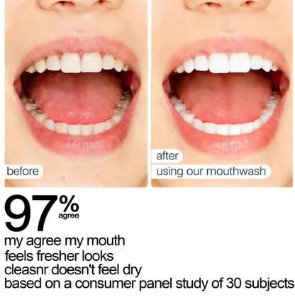 ✨ SEATLIKE Stain Whitening Mouthwash 🌿 |Say Goodbye to Surface Stains and Hello to a Brighter Smile-9SLL