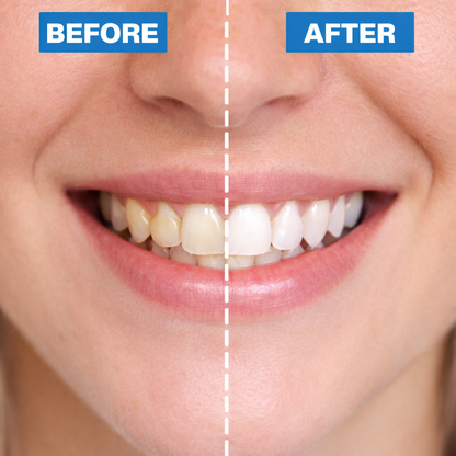 ✨ SEATLIKE Stain Whitening Mouthwash 🌿 |Say Goodbye to Surface Stains and Hello to a Brighter Smile-9SLL
